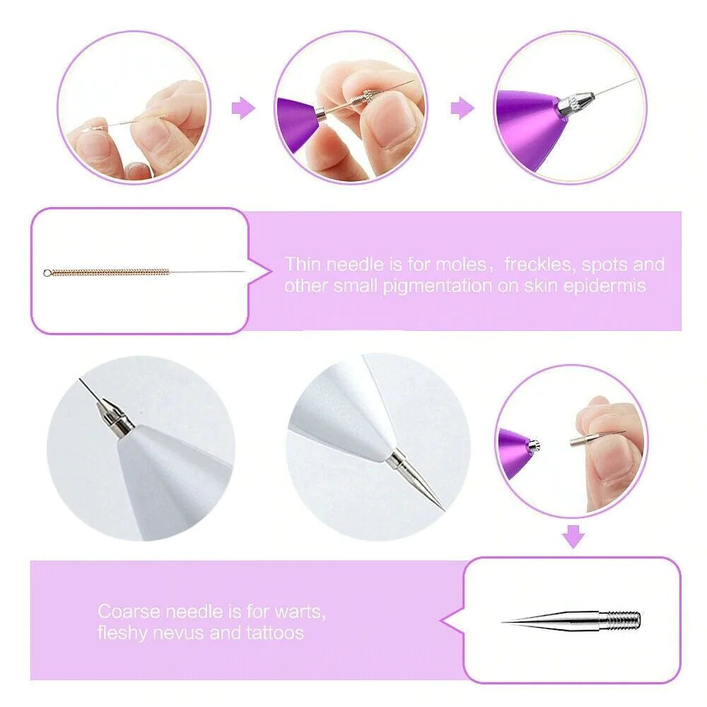 Laser Plasma Pen – Mole & Dark Spot Remover