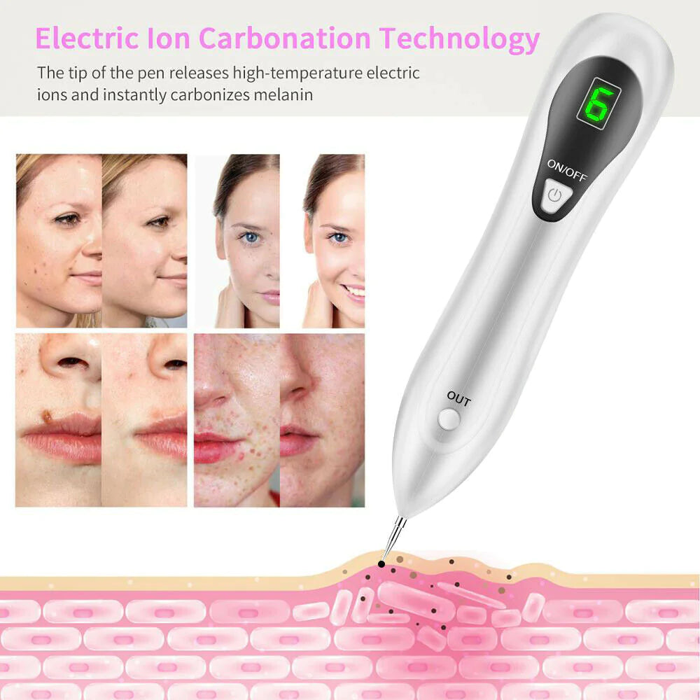 Laser Plasma Pen – Mole & Dark Spot Remover