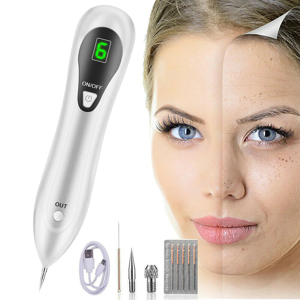 Laser Plasma Pen – Mole & Dark Spot Remover